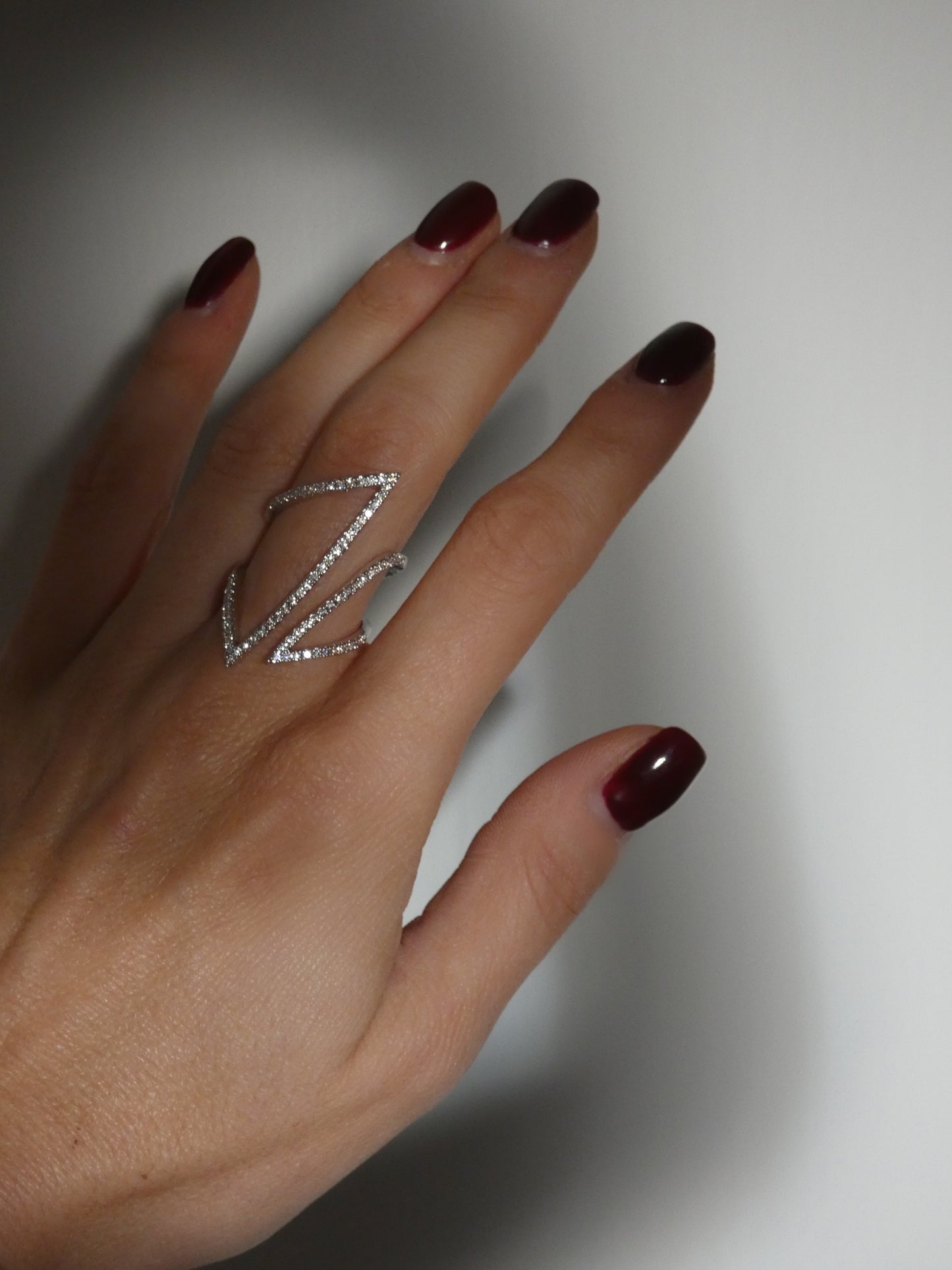 Anello Cesy
